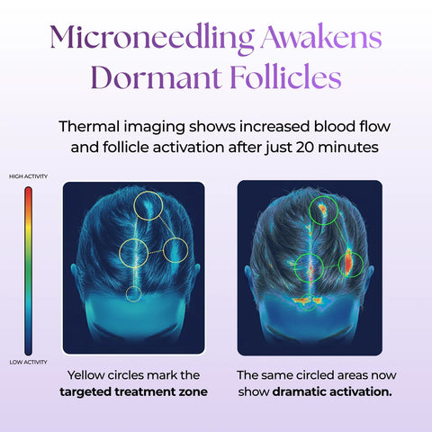 Ever Glo Hair Regrowth Micro-Infusion System for Woman